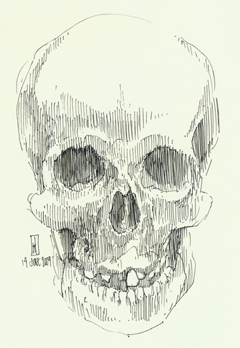 "Skull of Mary Ashberry (Mütter Museum)" is copyright © 2009 by James G. Mundie. All rights reserved.  Reproduction prohibited.