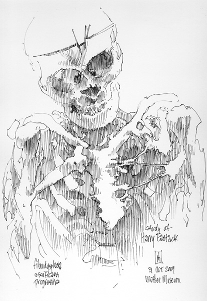 "Skeleton of Harry Eastlack (Mütter Museum)" is copyright © 2009 by James G. Mundie. All rights reserved.  Reproduction prohibited.
