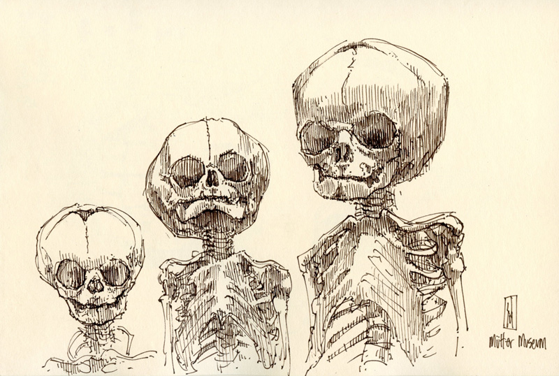 "Fetal Skeletons (Mütter Museum)" is copyright © 2011 by James G. Mundie. All rights reserved.  Reproduction prohibited.