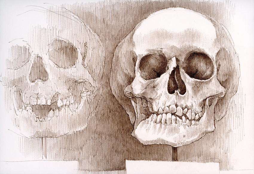 "No. 1006.080 – Czech (Mütter Museum)" is copyright © 2013 by James G. Mundie. All rights reserved.  Reproduction prohibited.