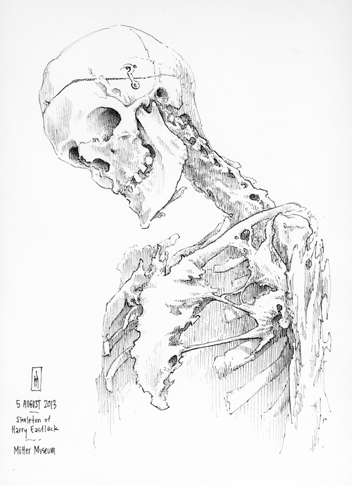 "Harry Eastlack’s remains (Mütter Museum)" is copyright © 2013 by James G. Mundie. All rights reserved.  Reproduction prohibited.