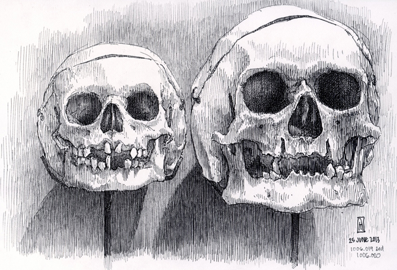 "No. 1006.019 and 1006.020 (Mütter Museum)" is copyright © 2013 by James G. Mundie. All rights reserved.  Reproduction prohibited.