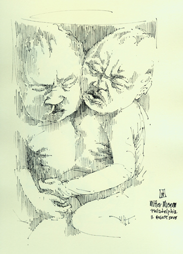 "Conjoined twins (Mütter Museum)" is copyright © 2008 by James G. Mundie. All rights reserved.  Reproduction prohibited.