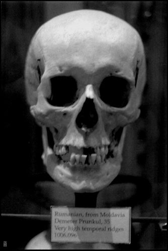 "Rumanian, from Moldavia (Hyrtl Skull Collection)" is copyright  2008 by James G. Mundie. All rights reserved.  Reproduction prohibited.