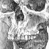 Skull of a Giant (Mütter Museum)
