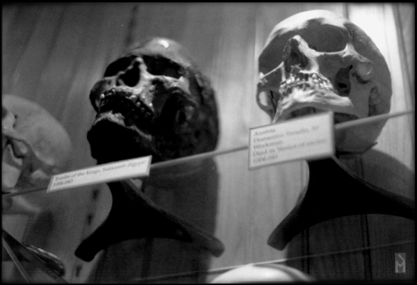 "Categorized skulls (Hyrtl Skull Collection)" is copyright © 2008 by James G. Mundie. All rights reserved.  Reproduction prohibited.